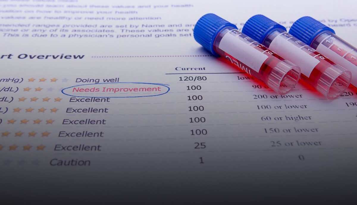 Retrasos en pruebas de laboratorio